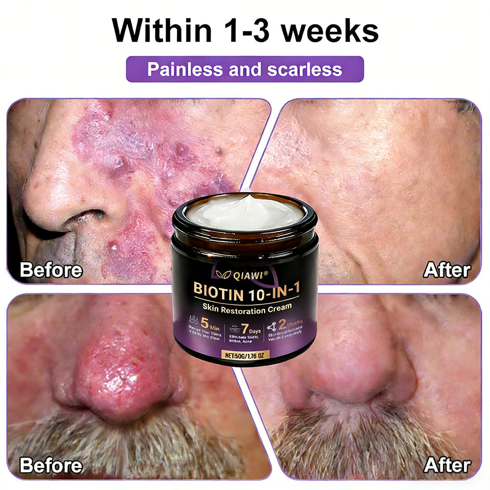 Made and Shipped from USA ✨QIAWI® Biotin 10-in-1 Skin Restoration Cream 🍀